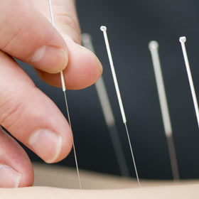 Acupuncture and Chinese Medicine to balance your body at Shen Dao Rochester Acupuncture MI